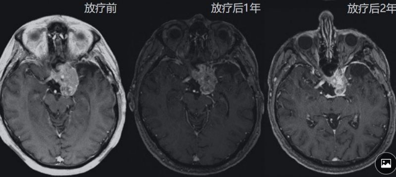 wuwei