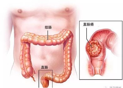 wuwei