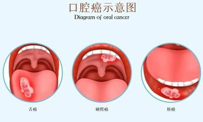 wuwei