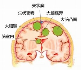 wuwei