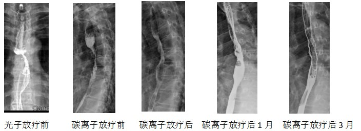 wuwei