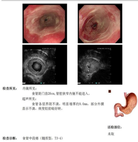 wuwei