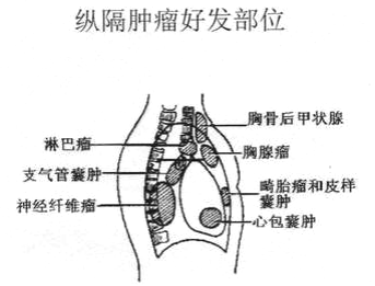 wuwei