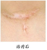wuwei