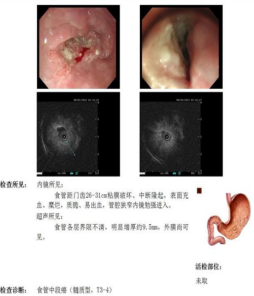 wuwei