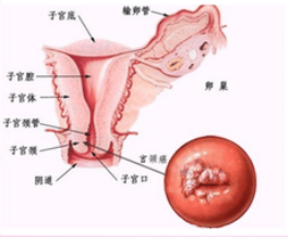 wuwei