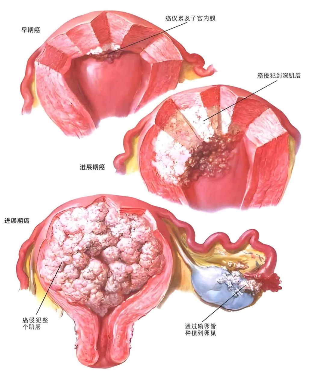 wuwei