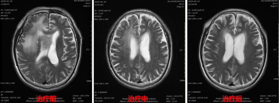 wuwei