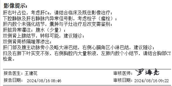 wuwei
