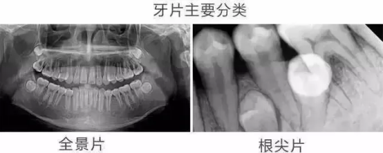 wuwei