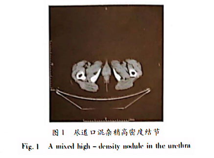 wuwei