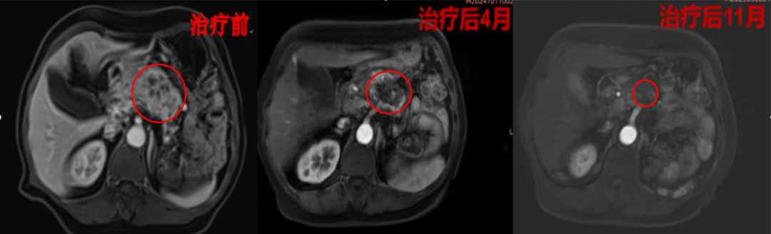 wuwei