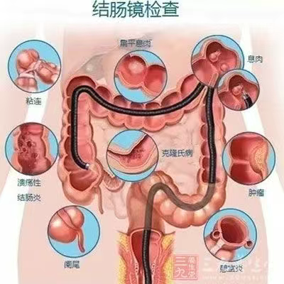 wuwei