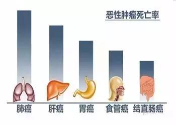 wuwei