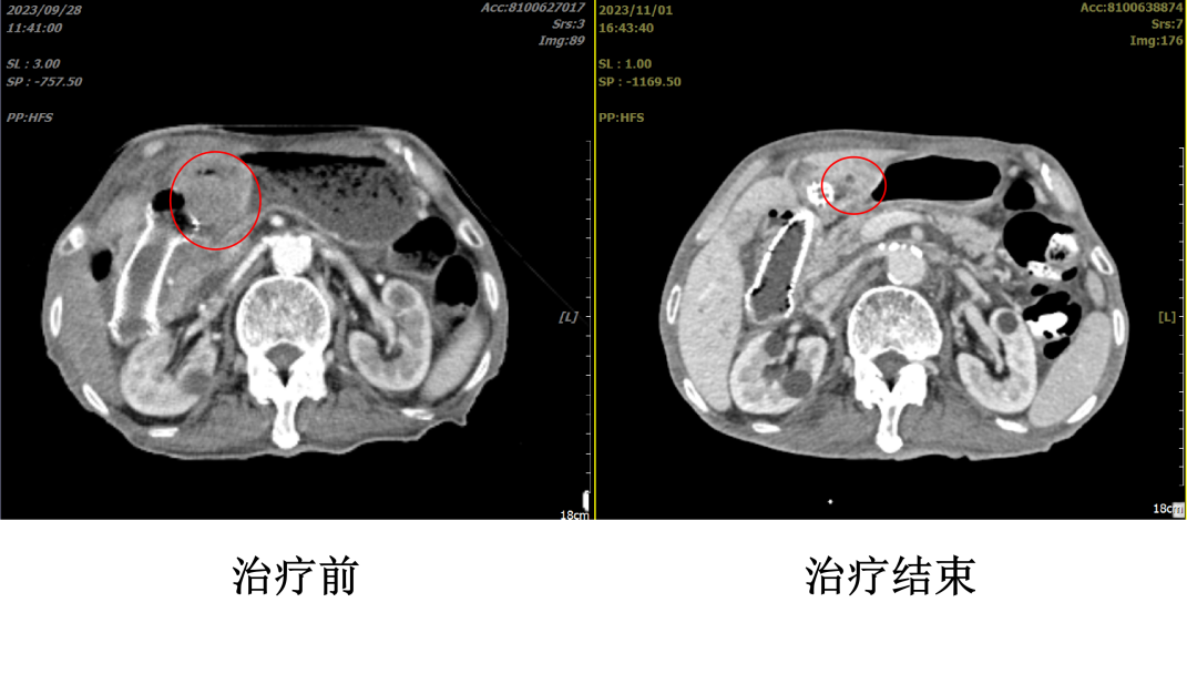 wuwei