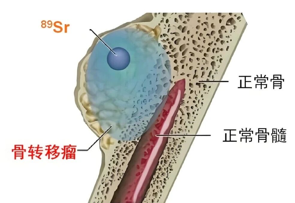 wuwei