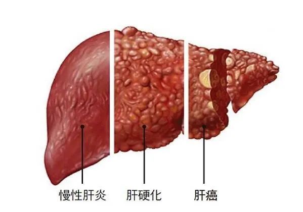 wuwei