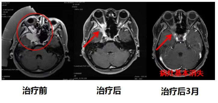 wuwei