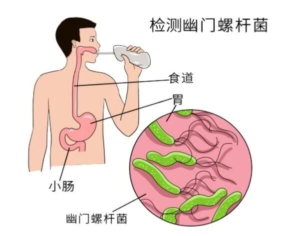 wuwei