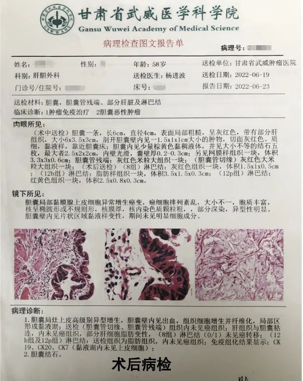 wuwei