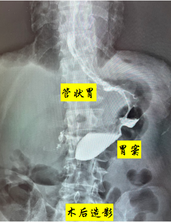 wuwei