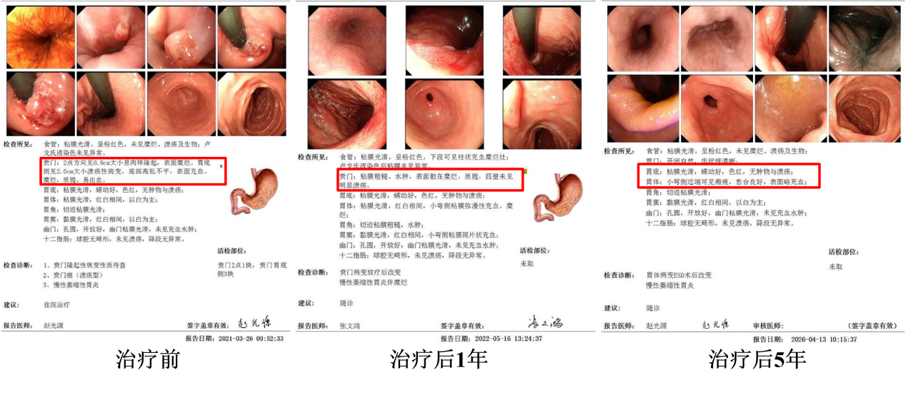 wuwei
