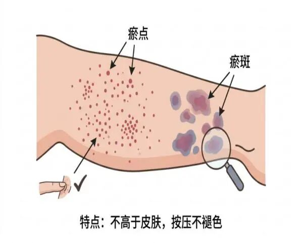 wuwei