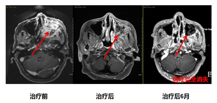 wuwei