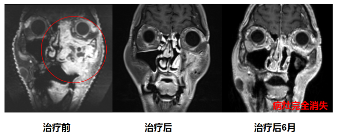 wuwei