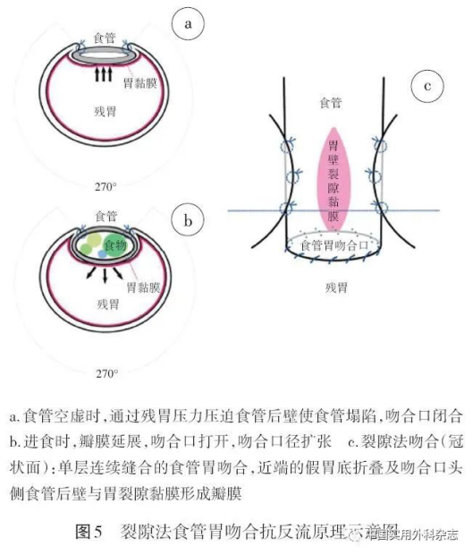 wuwei