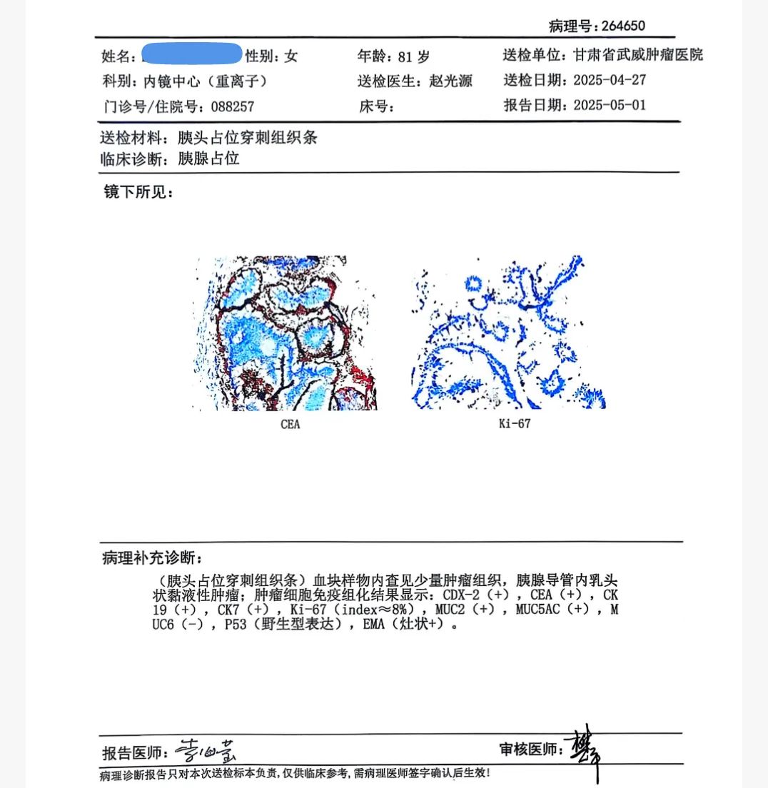 wuwei
