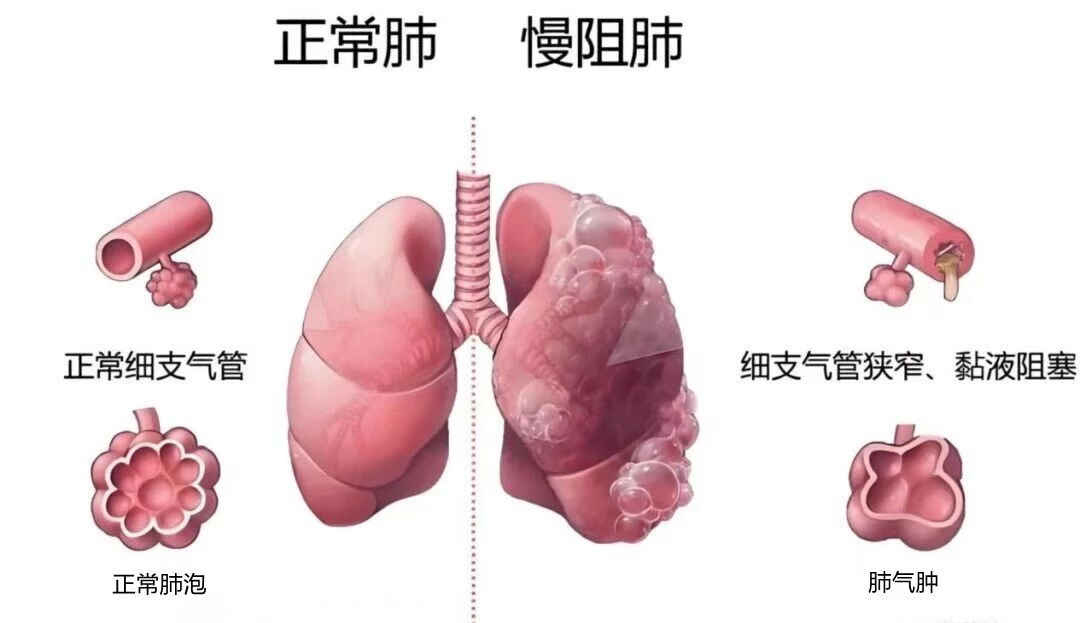 wuwei