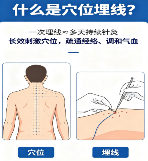 wuwei