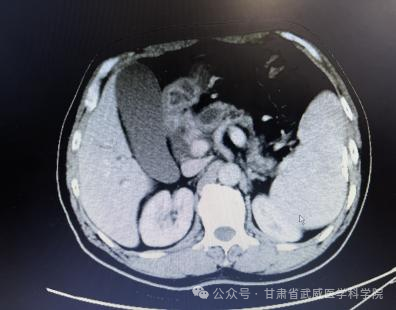 wuwei