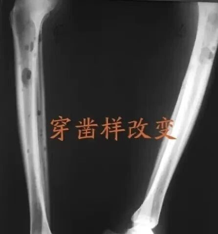 wuwei