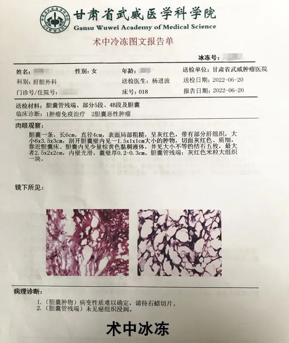wuwei