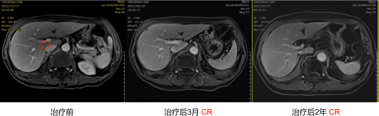 wuwei