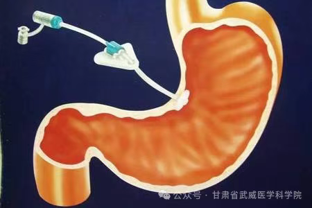 wuwei