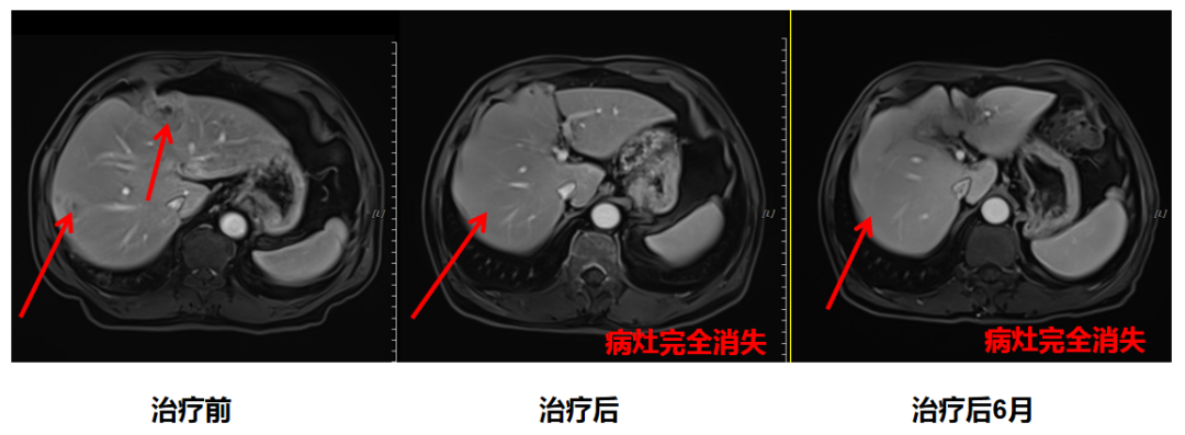 wuwei