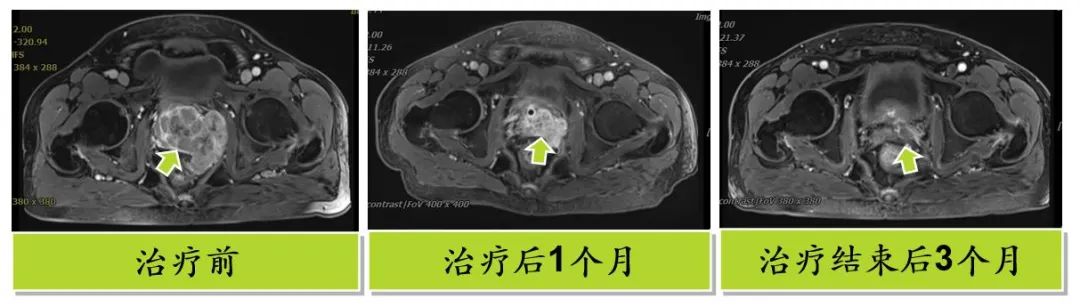 wuwei