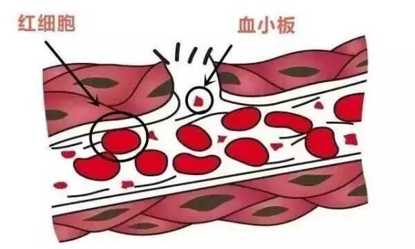wuwei