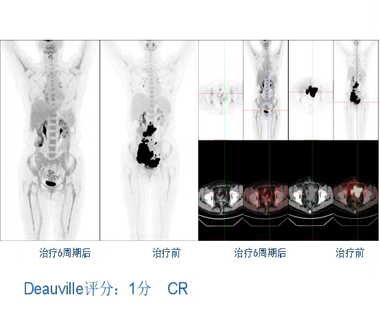 wuwei