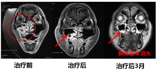 wuwei
