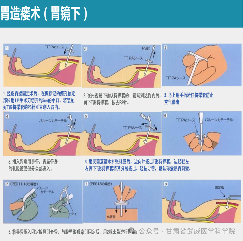 wuwei