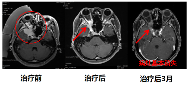 wuwei