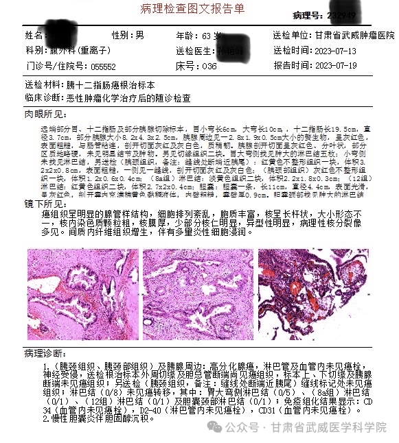 wuwei