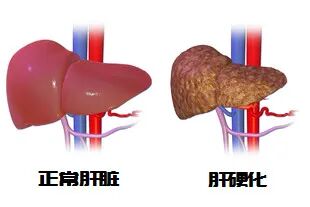 wuwei