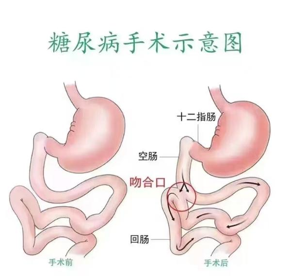wuwei
