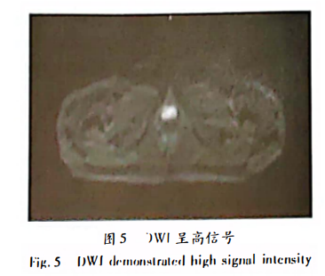 wuwei