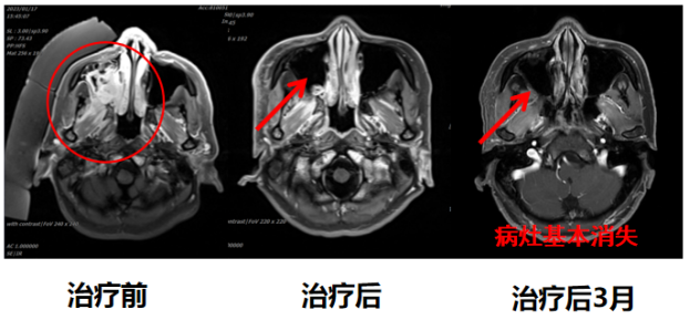 wuwei